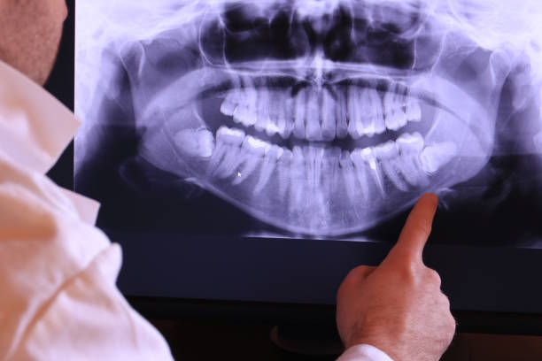 Best Tooth Infection Emergency Dentist  in Spring Valley, NY
